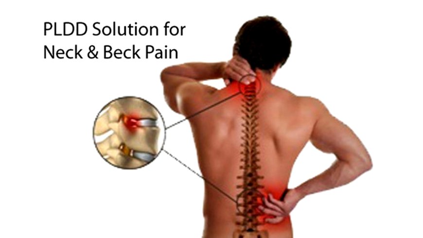 ফিজিওথেরাপি বনাম ব্যথার ওষুধ